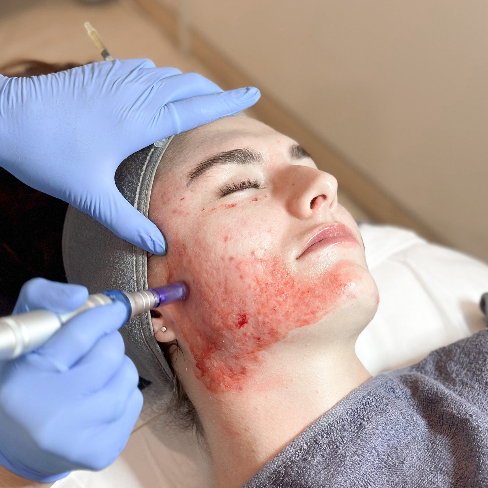 Best Cosmetic & Dental Clinic in Dubai