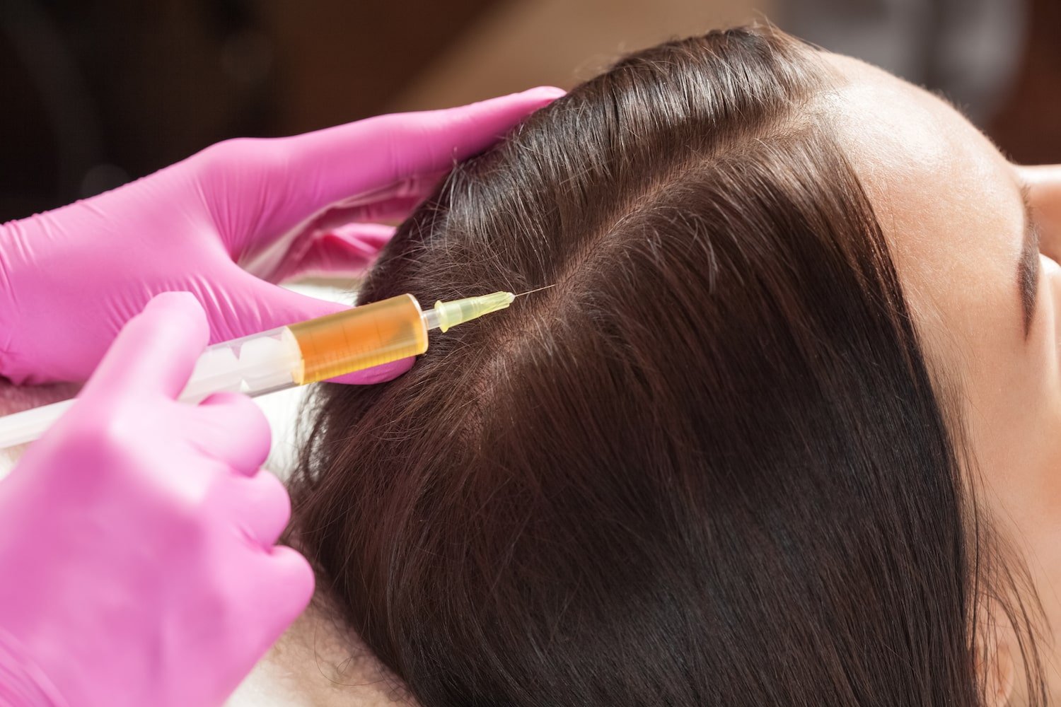 Hair Plasma Dubai