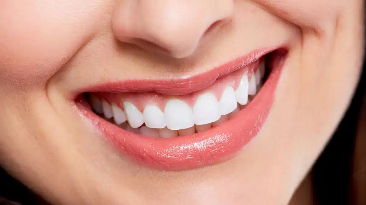 Cosmetic Dent In Dubai
