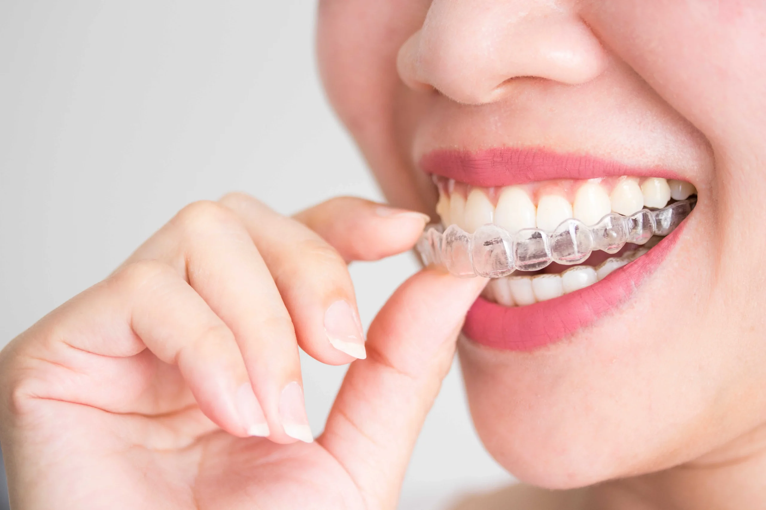 Orthodontist Dubai
