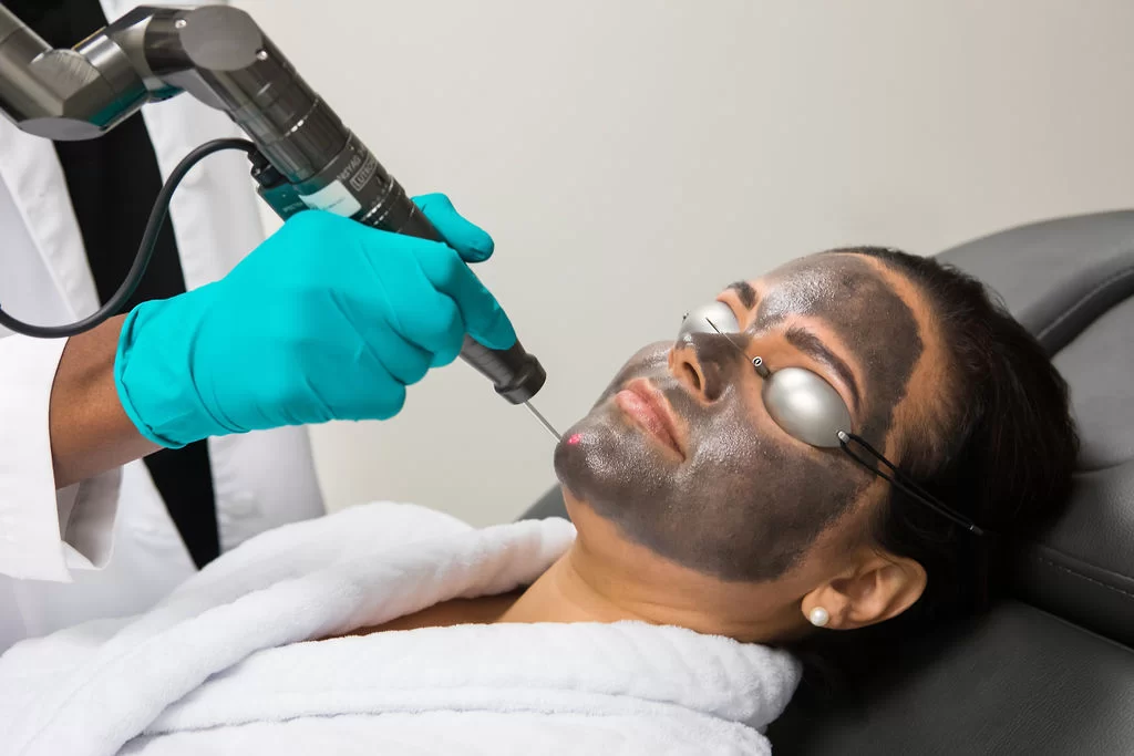 Carbon Laser Treatment