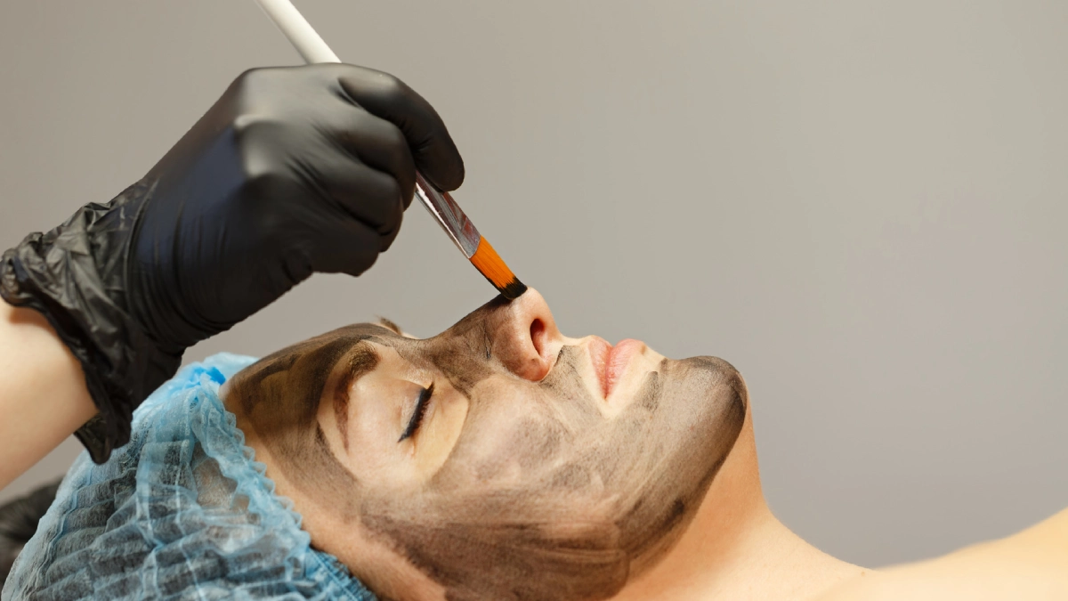 Charcoal Laser Facial Near Me