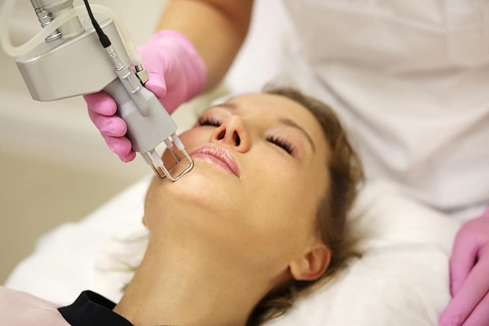 How Effective Is Laser Skin Resurfacing for Deep Acne Scars?