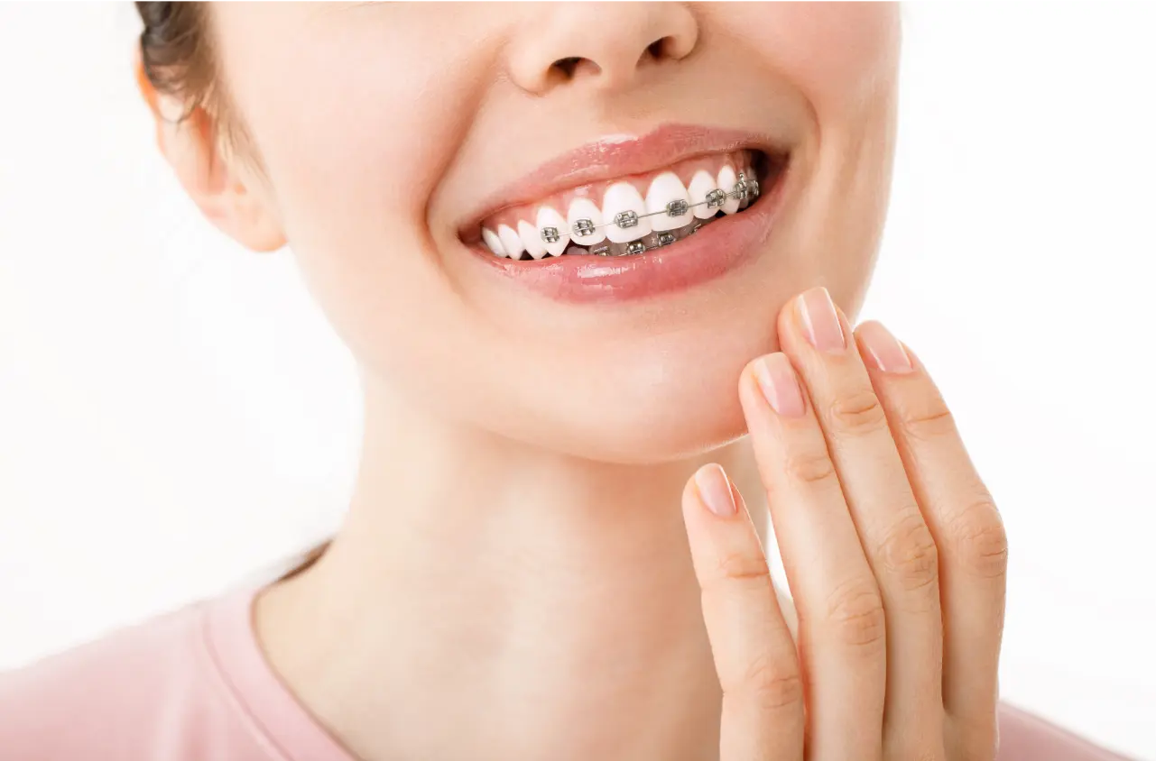 Cheapest Invisalign In Dubai