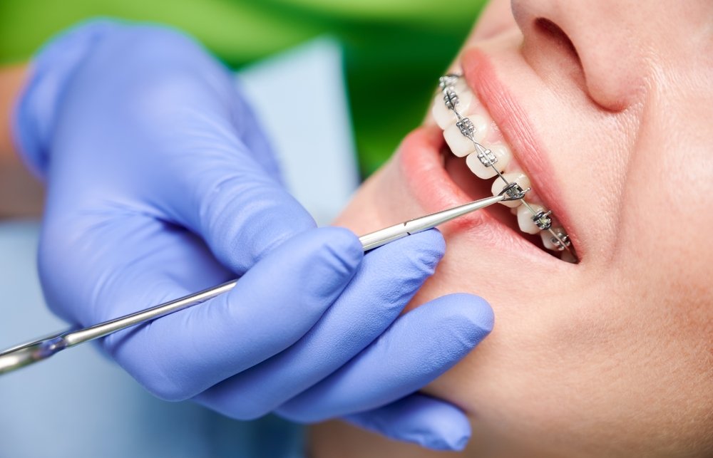 Orthodontist Dubai