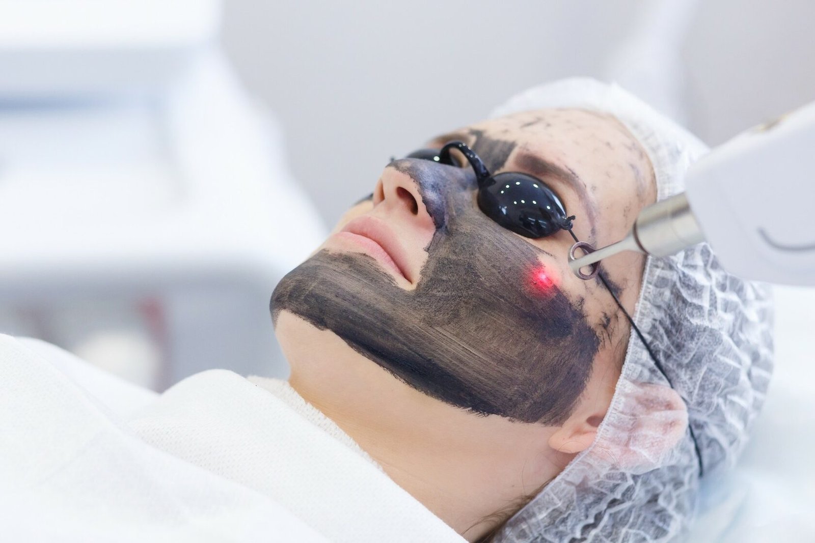 Hollywood Laser Peel