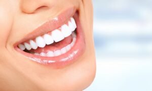 Best Cosmetic & Dental Clinic in Dubai TMJ treatment